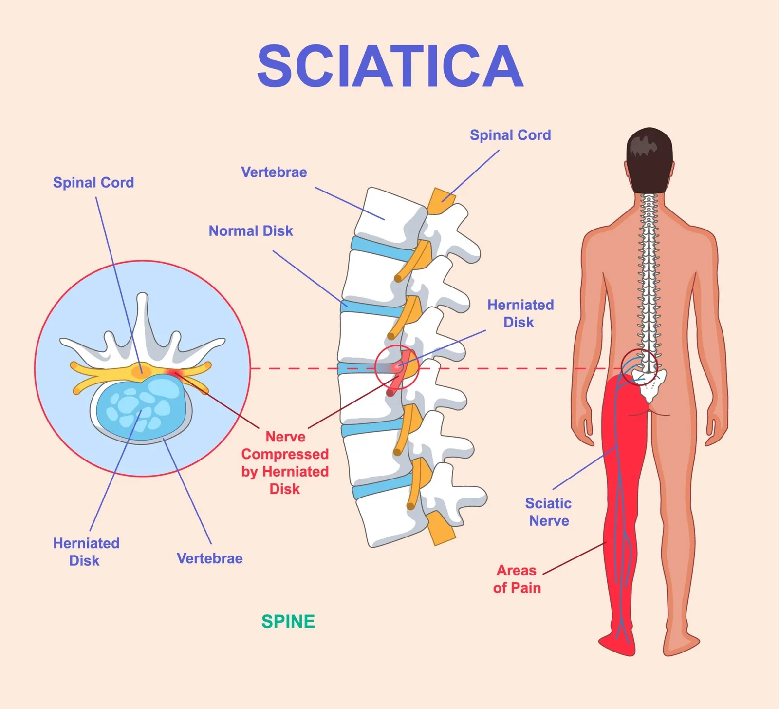 Acupoints for back pain release